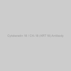 Image of Cytokeratin 18 / CK-18 (KRT18) Antibody